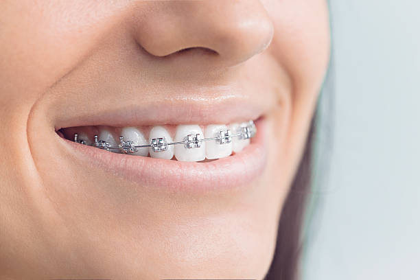 Best TMJ/TMD Treatment  in Cape Canaveral, FL